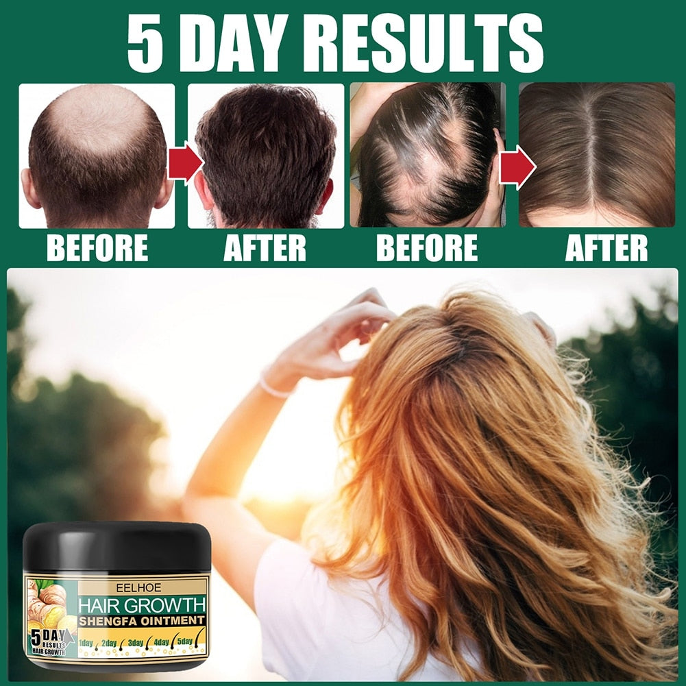 Hair Loss Treatment Growth Cream