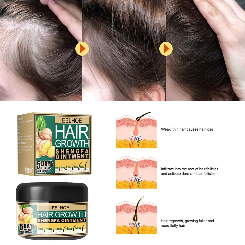 Hair Loss Treatment Growth Cream